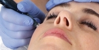 Dermatude cosmetic facelift