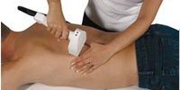 IPL hair removal