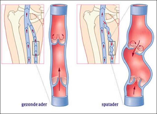 Verschillen tussen een ader en een slagader